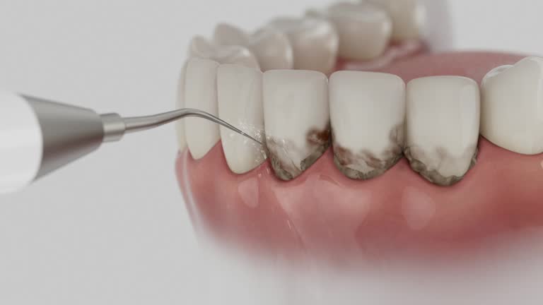 Trusted Dental Implants service in Kiln, MS - Dentist Open Now